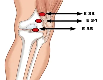 Points d'acupression Estomac E35, E34, E33 pour douleur au genou. ledegoteur.fr