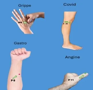 3 Acupuncture Pour grippe COVID Gastro angine ledegoteur.fr