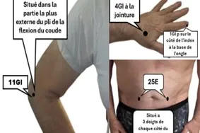 7 points d'acupuncture Pour faciliter le transit ledegoteur.fr